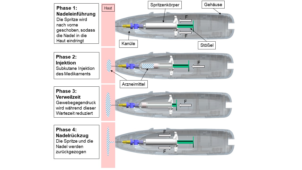 Die vier Phasen der Injektion: Einstechen der Nadel, Injektion, Verweildauer und Herausziehen der Nadel